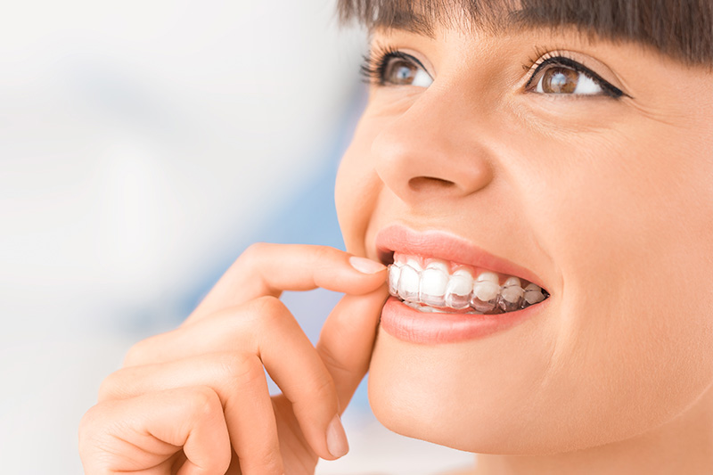 Invisalign in Cypress